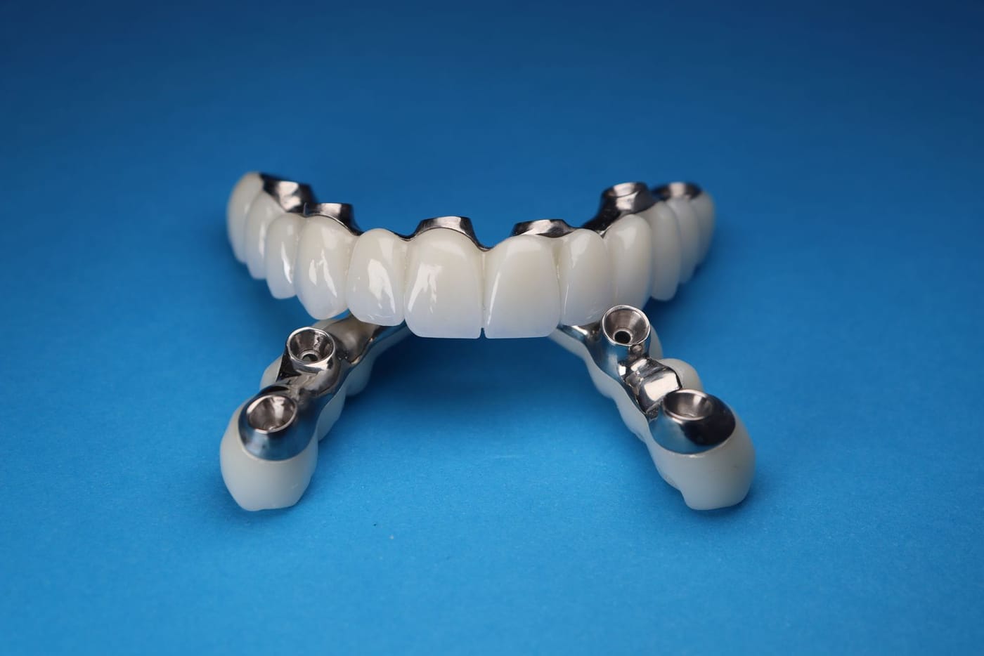 A full arch dental bridge on implant abutments against a blue background