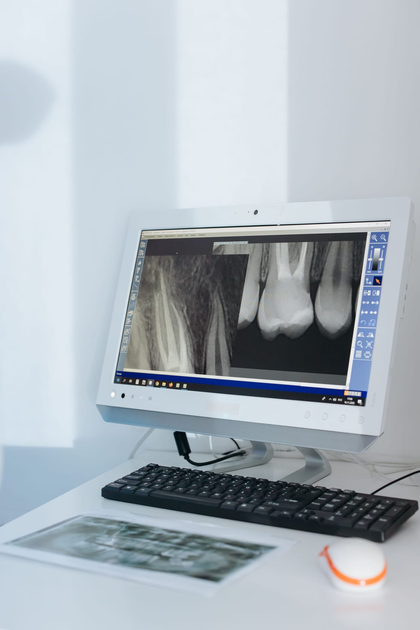 A dental X-ray on a computer screen